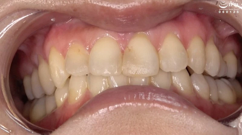 AD-0184-0 JAV Movie Cover